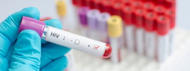 Autoteste para detecção do HIV deve estar à venda no primeiro semestre de 2016