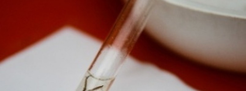 Laboratrio francs inicia pesquisa de vacina contra o vrus Zika