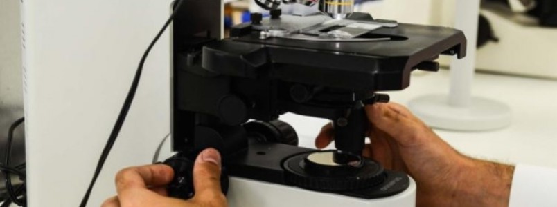 Técnica nacional reduz ação de melanoma