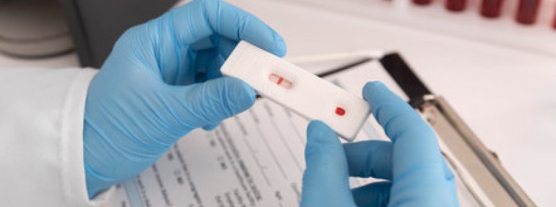 Colesterol, dengue e HIV: Anvisa autoriza realizao de exame de anlise clnica em farmcias