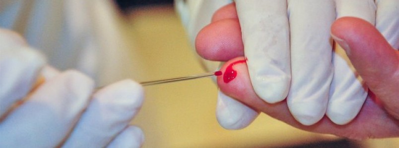 Exames de Zika serão obrigatórios para planos de saúde a partir desta semana