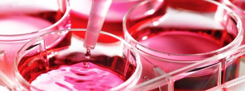 Transplante de Medula Óssea