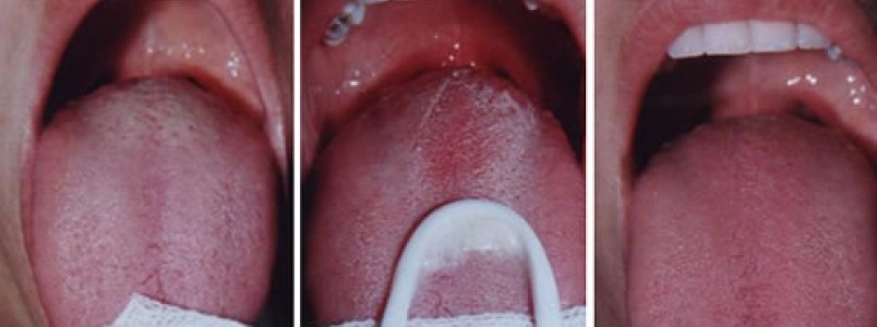 Quais medidas devem ser adotadas para a manuteno da sade bucal?