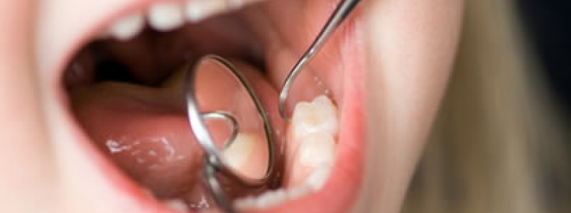 Você já olhou os dentes do seu filho hoje?