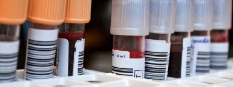 Saiba quando é a hora certa para fazer o check-up e quais exames são indicados