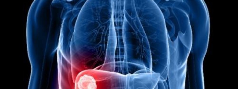 Brasil ganha destaque na detecção da hepatite; meta é erradicar a doença até 2030