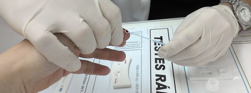 Unidade móvel vai oferecer teste rápido de HIV