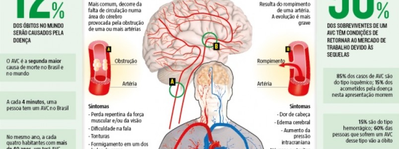 Ministério recebe nesta sexta sugestões sobre cuidados para AVC