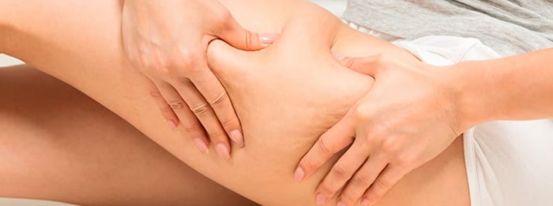 6 dicas para reduzir a retencão de líquido