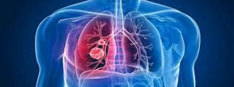 Brasil assume conselho de entidade que combate a tuberculose no mundo