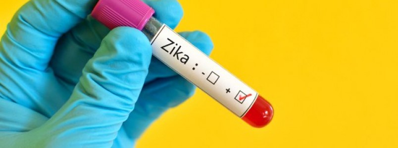 O que  falso e o que  verdadeiro nos boatos sobre zika vrus