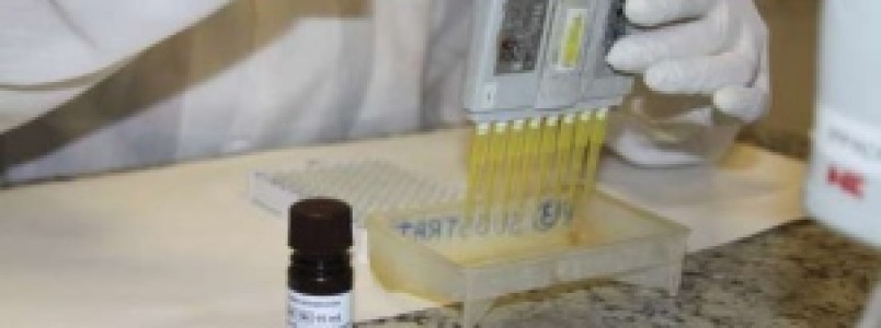 Fundação Ezequiel Dias desenvolve exames para agilizar diagnósticos de zika e dengue em Minas