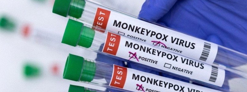 Exame descarta caso de varíola do macaco no Rio de Janeiro