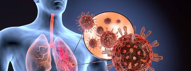 Quais as lesões que a covid-19 e a gripe podem causar nos pulmões