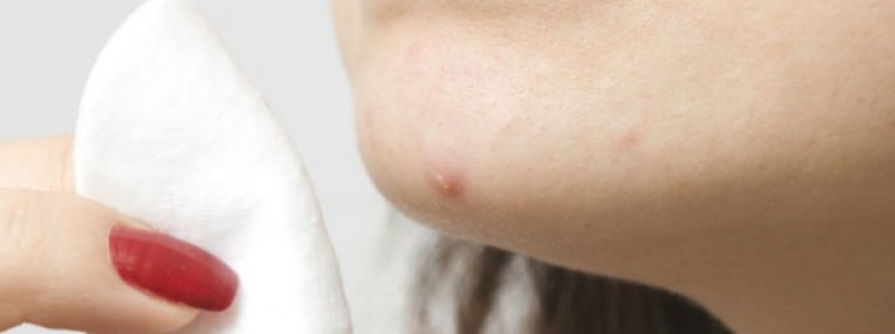 Pele seca com acne: o que fazer? Por que acontece?