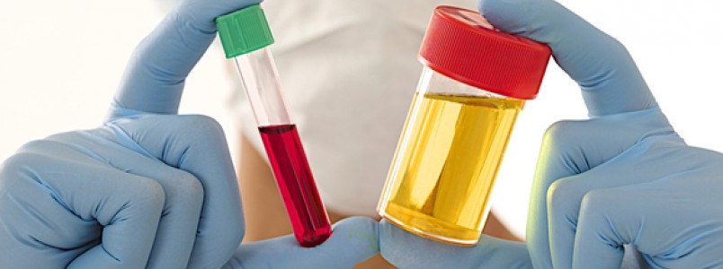 Infeccção urinária: Necessidade de repetir exames