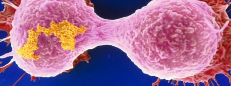 Novo tratamento contra câncer dá esperança a pacientes terminais de leucemia