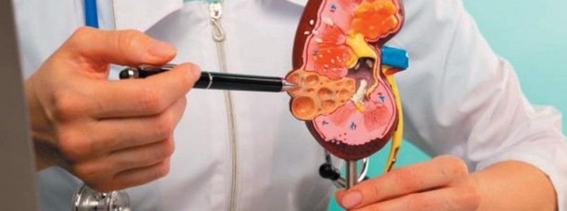 Uso de anti-inflamatórios sem orientação médica pode agravar doenças renais