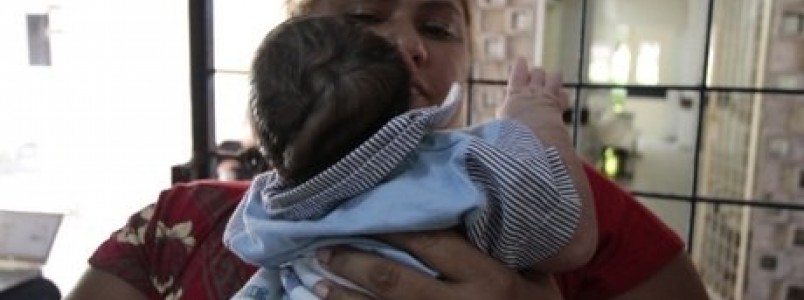 Médico do PE teme chegada do surto de microcefalia outras regiões do País