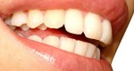 Saiba quais hbitos podem prejudicar a sua sade bucal
