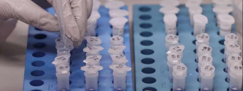Vale compra 5 milhões de kits para verificar infecção pela Covid-19