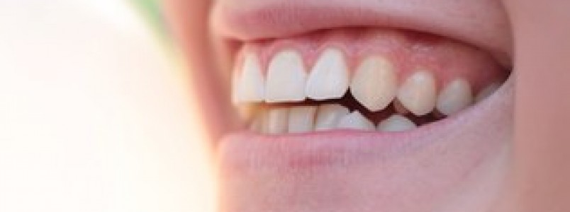 10 doenças que podem dar os primeiros sinais na boca