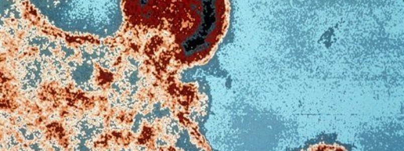 Pesquisadores descobrem proteína inibidora do HIV