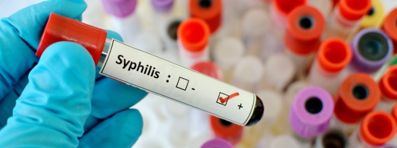 Brasil vive epidemia de sífilis. Feridas no órgão sexual, febre e dor de cabeça são sinais da doença
