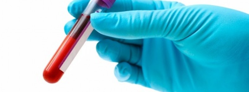 SUS oferecerá novo tratamento contra hepatite C