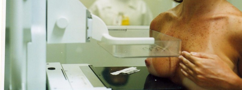 40% das mulheres de 50 a 69 anos não fazem mamografia