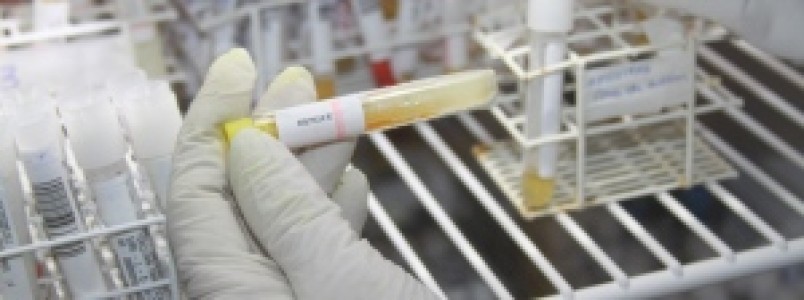 Portaria regulamenta participao de laboratrios do estado na Rede de Dengue