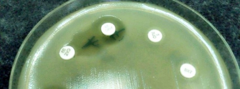 Cientistas acabam de anunciar a melhor aposta para acabar com as superbactérias