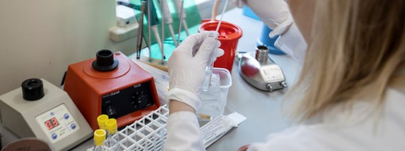 Anvisa aprova testes rápidos para Covid-19 em farmácias