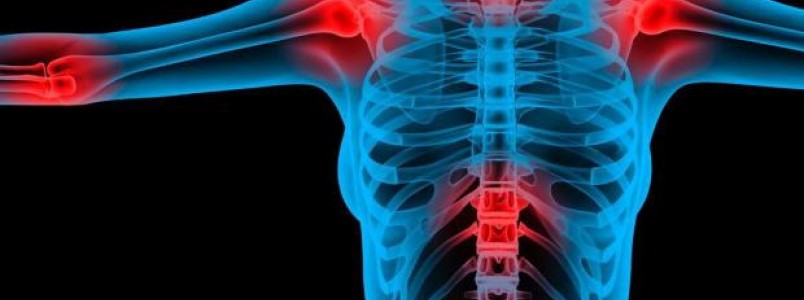 Como lidar com a Fibromialgia em 8 passos