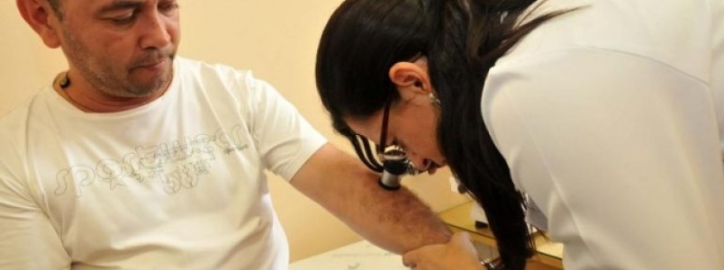 BH terá exames gratuitos para detecção de câncer de pele e DSTs neste sábado